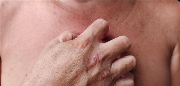 Hautprobleme bei Diabetikern: Ursachen und Lösungen