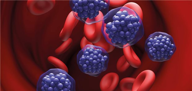 Patientenfälle aus der Versorgungsrealität: Tafasitamab plus Lenalidomid