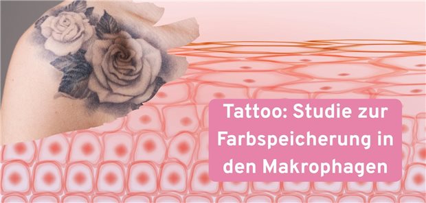 Neue Erkenntnisse wie Makrophagen Tattoofarben speichern