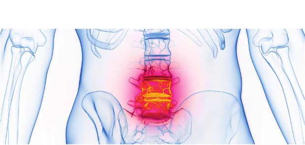 CRP-Wert-unabhängig therapieren mit Ixekizumab