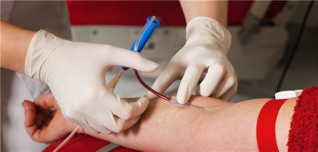 Was bringt die Messung von Lipoprotein(a)?