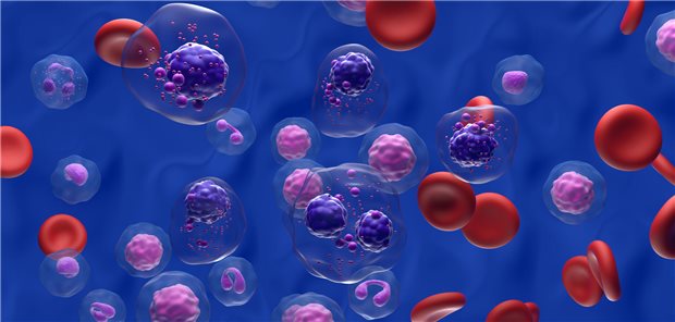 Langfristig überlegen: Kombinationen mit Daratumumab in der Erstlinie