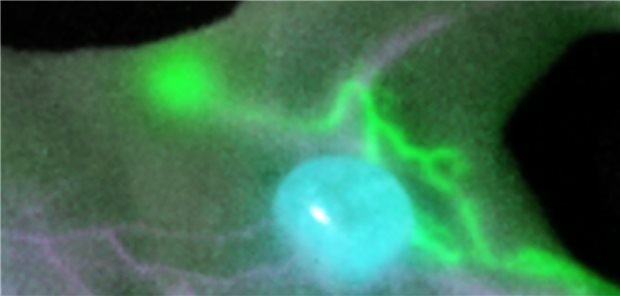 Bild einer Maus mit der Fluoreszensbildgebung: Ihr Tumor an der rechten Flanke erscheint blau, Lymphgefäße grün und Blutgefäße magenta.