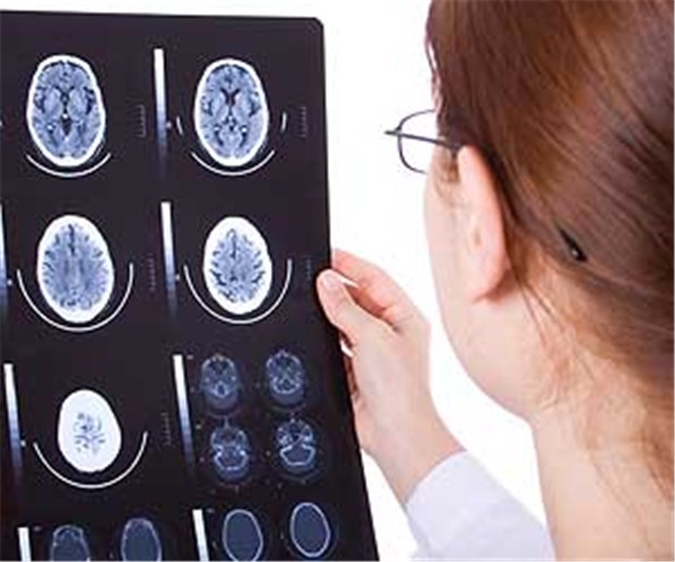 Alzheimer-Erkrankung ohne Erinnerungslücken Bilder vom Gehirn unterstützen die Differenzialdiagnostik bei Verdacht auf Alzheimer.