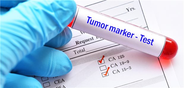 Biomarker-Testung im Labor. Regelhaft abrechnen können diese Tests derzeit nur die niedergelassenen Onkologen.
