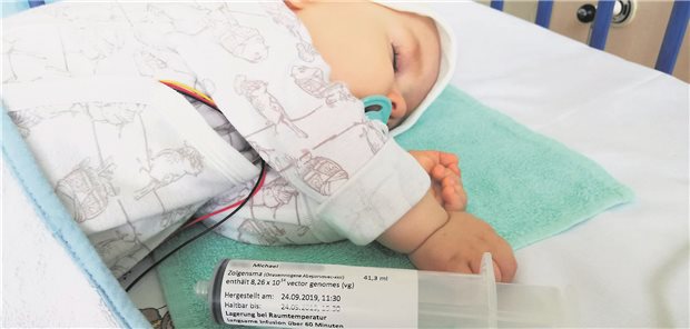Bis zum Ende des zweiten Jahres und bis zu 13,5 Kg Körpergewicht ist die Gentherapie mit Zolgensma indiziert.