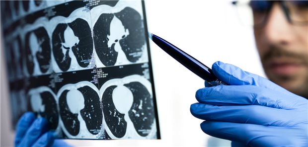 Ein Arzt schaut sich das CT-Bilder der Lunge eines Patienten an.