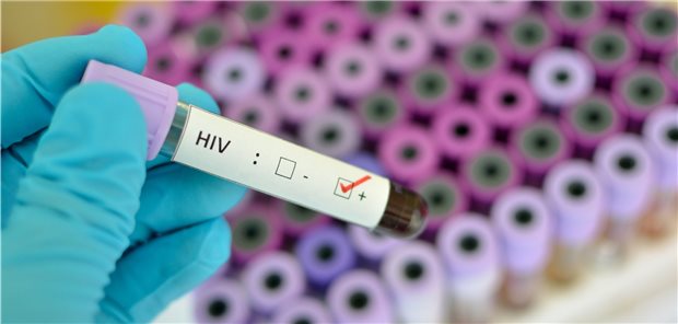 HIV-Praxen halten der Krise stand Bleiben HIV-Infizierte wegen Corona den Praxen fern? Hier und da ja. Viele Praxen haben aber trotz Pandemie noch gut zu tun.