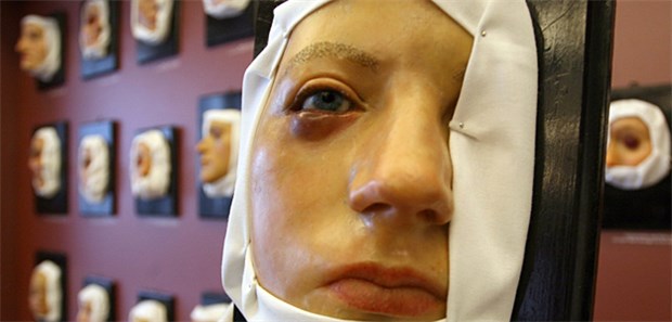 Das Comeback der Moulagen "Blepharitis marginalis sicca, Chalazion" lautet der medizinische Name der Krankheit, die mit dieser Moulage, einem Wachsabguss, in der Berliner Charité gezeigt wurde.