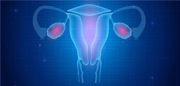 Blick auf den Uterus: Das IQWiG hat Therapieoptionen beim Endometriumkarzinom untersucht.