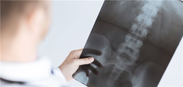 Blick auf die Röntgenaufnahme. Hätte man auf die Untersuchung verzichten können?