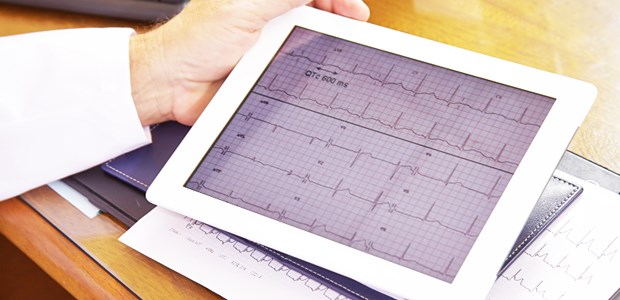 Sachsen-Anhalt nimmt Herzinfarkte unter die Lupe Blick auf ein EKG. In Sachsen-Anhalt soll ein regionales Herzinfarktregister helfen, die Zahl der Todesfälle durch Infarkte zu senken.