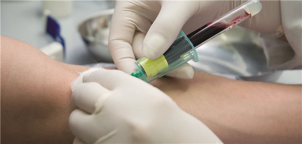 Onkologen und Selbsthilfe warnen vor falschen Erwartungen an EDIM-Tests Blutabnahme
