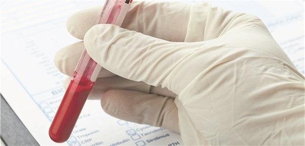 Blutabnahme als Teil einer Prä-Op-Leistung? Dann gehört das auf einen Privatlabor-Schein! (c) Shawn Hempel / stock.adobe.com