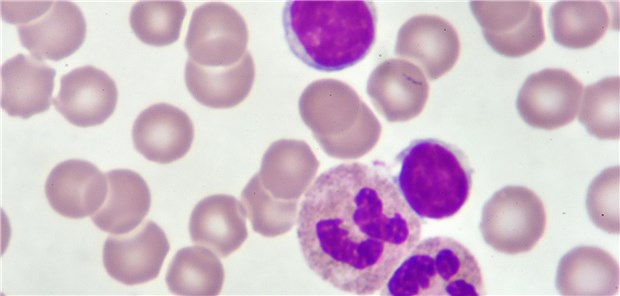 Blutausstrich bei CLL: Wie hoch ist die Überlebenswahrscheinlichkeit eines Patienten mit rezidivierter oder therapierefraktärer CLL unter einer modernen gezielten Therapie?