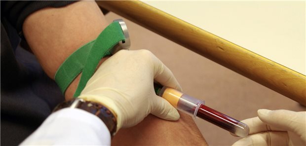 Blutentnahme: Bei erhöhten Lipase-Werten sind manchmal bestimmte Medikamente wie Diuretika oder Kontrazeptiva der Grund.