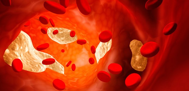 Die neue Lockerheit Blutgefäß im Blick: Auch bei den Leitlinien zur Cholesterinsenkung hat sich einiges getan.