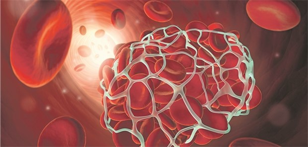 Blutgerinsel: Therapieziel ist die optimale Balance von Thrombose-Prävention und Blutungsrisiko.