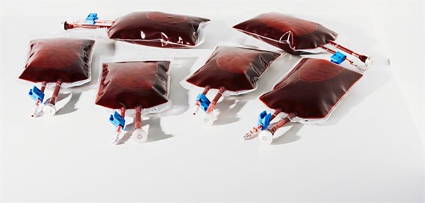 Ewige Jugend made in Silicon Valley Blutige Angelegenheit: Mit eineinhalb Liter Blutplasma von Spendern unter 25 Jahren will man im Silicon Valley Freiweillige verjüngen.