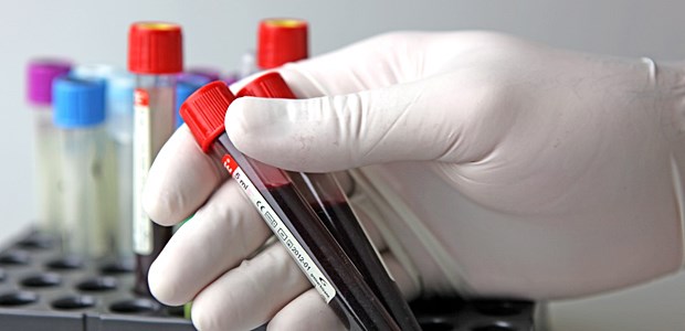 Blutprobe: Anonyme HIV-Tests sollen mehr Menschen erreichen.