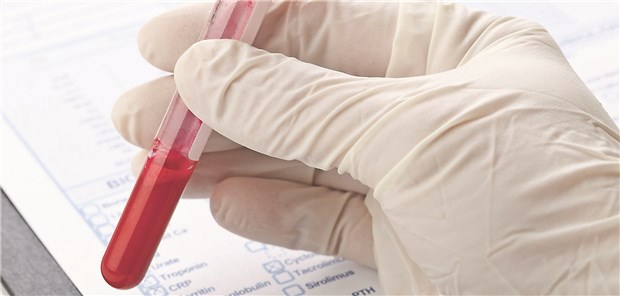 Blutprobe für einen Interferon-Gamma Release Assay (IGRA).