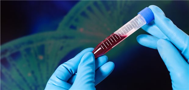 Blutprobe wird beurteilt: Bisher wurde der Faktorspiegel im Blut zur Bewertung von Präparaten bestimmt.