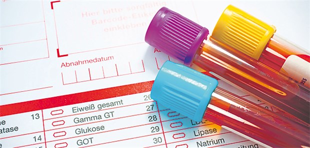 Funktionelle Eigenschaften stärker im Fokus Blutprobe zur Cholesterin-Messung.