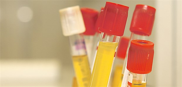 Drug Monitoring verbessert Erfolg Blutproben: Künftig Option für das therapeutische Drug Monitoring bei Krebs?