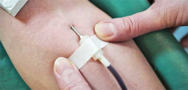 Aderlass gegen Hypertonie Blutspende: Manchmal könnte der Aderlass auch für die Gesundheit des Spenders nützlich sein.