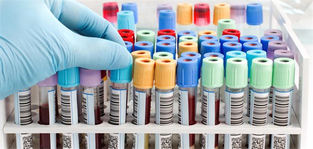 Bluttests verbessern offenbar Alzheimer-Diagnostik bei Hausärzten Mehrere Röhrchen mit Blut gefüllt