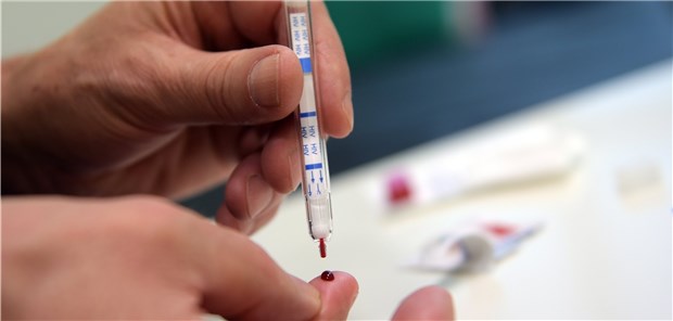 Chance für mehr frühe HIV-Diagnosen Bluttest auf HIV: Einfach in der Anwendung und sicher?