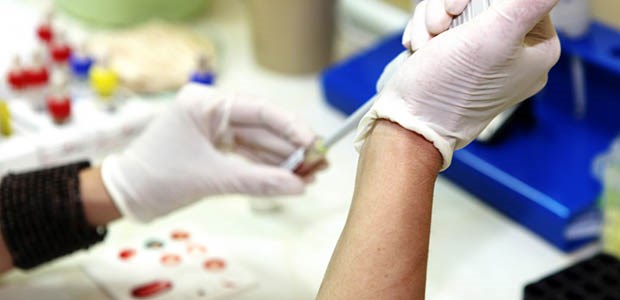 Nutzenbewertung in der Kritik Bluttests führen auf die Spur des HI-Virus. Eine frühe Diagnose erhöht die Chancen der Therapie.