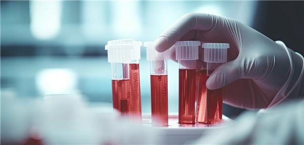 Laborärzte kritisieren Lauterbachs Bluttest-Pläne in Apotheken Bluttests im Labor.