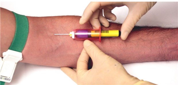 Blutuntersuchung: Bei nahezu jedem zweiten Patienten mit Herzinsuffizienz wird ein Eisenmangel diagnostiziert.