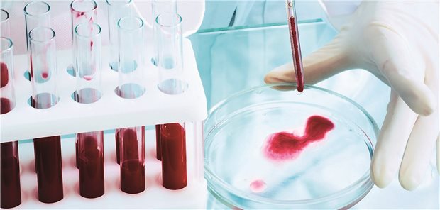 Blutuntersuchung: Der SARS-CoV-2-Antikörper-Nachweis im Schnelltest ist nicht für den Gebrauch durch den Patienten vorgesehen, sondern ausschließlich für medizinisches Fachpersonal.