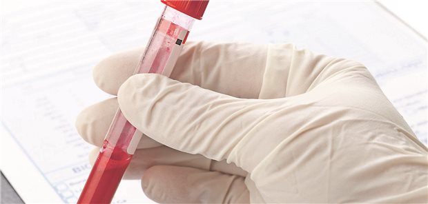 Ein Allgemeinmediziner prüft den Cholesterinspiegel eines Patienten anhand der Ergebnisse eines Blutfetttests.