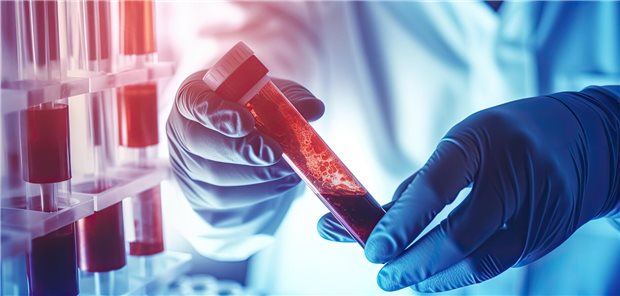 Forscher mit Reagenzglas, das Blut enthält.