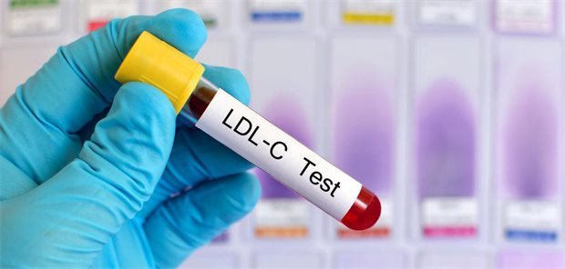 LDL-Cholesterin: Neue US-Leitlinie führt wieder Zielwerte ein Blutröhrchen mit der Aufschrift "LDL-C Test"