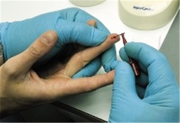 Fast zwei Millionen Diabetiker unerkannt Blutzuckermessung - Voraussetzung für Gefäßschutz.