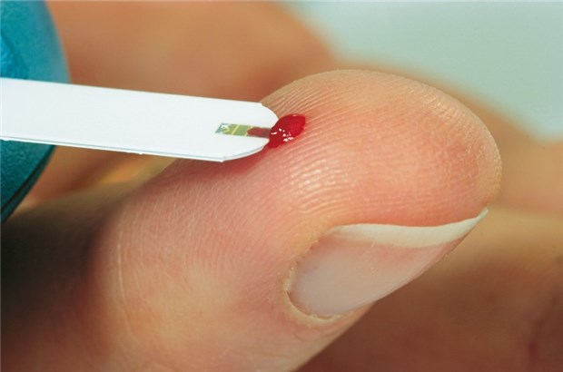 Intensive Blutzuckereinstellung bei Typ-2-Diabetes ist besonders früh nötig Blutzuckerselbstkontrolle an der Fingerbeere.