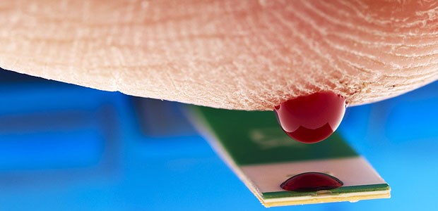 KV lässt sich auf strittigen Deal ein Blutzuckertest: Die Qualitätsziele bei der Einstellung von Diabetespatienten, die die Kassen im Rahmen der DMP Diabetes mellitus 1 und Diabetes mellitus 2 anstreben, stoßen bei Ärzten auf Widerspruch.