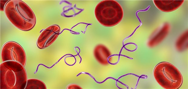Zahl der Borreliose-Diagnosen ist gestiegen Borrelia-Bakterien im Blut.