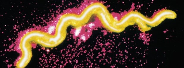 Bald einfacher Test auf Neuroborreliose? Borrelie unter dem Mikroskop. Der Nachweis der Keime bei Neuroborreliose ist bisher nicht gerade einfach.