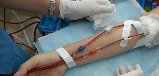 Branchenkenner befürchten, dass kleinere Dialyse-Zentren in ländlichen Gebieten schließen könnten. Ihnen fehlt es an Fachkräften.