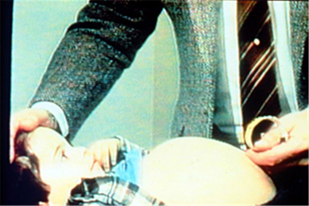 Orphan Drugs - ein Markt mit Eigenheiten Brian Berman im Alter von drei Jahren vor Aufnahme in die klinische Studie im Jahr 1984.