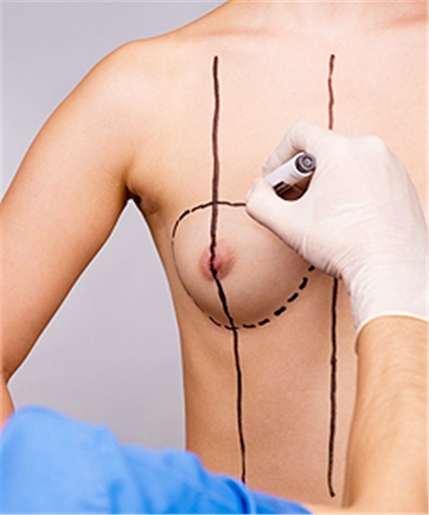 Die Top Ten der Schönheitsoperationen Brust-Op stehen bei Frauen hoch im Kurs.