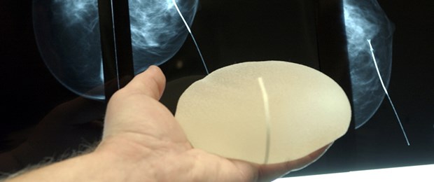 Silikonbrüste werden zum Versicherungsfall Brustimplantat: Die Versicherer wehren sich gegen die Haftung.
