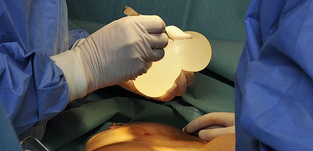 Ärzte fordern strengere MedTech-Zulassung Brustimplantate mit minderwertigem Industriesilikon, wie sie hier im Januar 2012 in Nizza einer Patientin entfernt werden, waren für die Petenten ein Anlass, eine strengere EU-Zulassungsprozedur einzufordern.