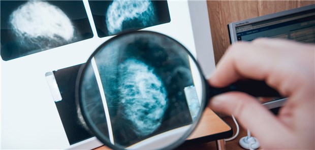 Brustkrebs? Auch gutartige Brustveränderungen sind wohl ein Grund zur Sorge.
