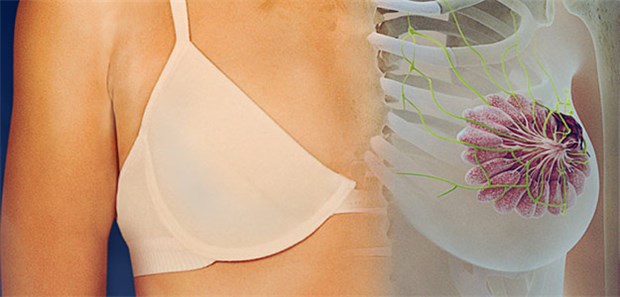 Genexpressionstest bei Brustkrebs bald Kassenleistung? Brustkrebs: Bei weniger als der Hälfte der erkrankten Frauen ist dann eine Chemotherapie eindeutig indiziert.